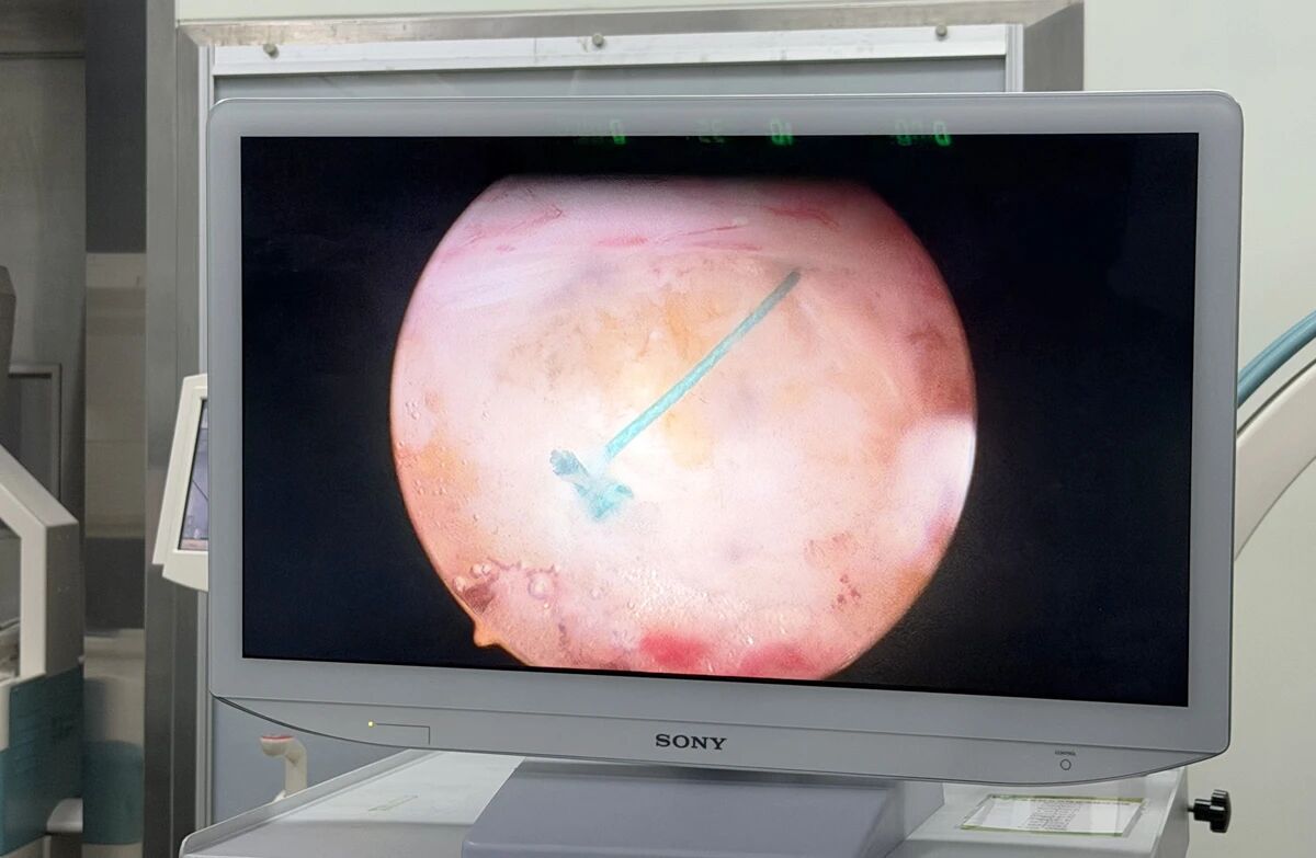 f0d863669041f915de66fa6d2a8178fe